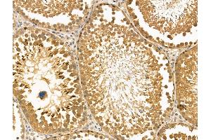 ABIN6262174 and ABIN6269018 at 1/100 staining Rat testis tissue by IHC-P.