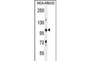 TRIM33 Antibody (C-term) (ABIN655994 and ABIN2845376) western blot analysis in MDA-M cell line lysates (35 μg/lane). (TRIM33 anticorps  (C-Term))