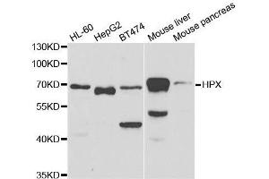 Western blot analysis of extracts of various cell lines, using HPX antibody. (Hemopexin anticorps  (AA 24-245))