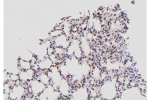 ABIN6276447 at 1/100 staining Mouse lung tissue by IHC-P.