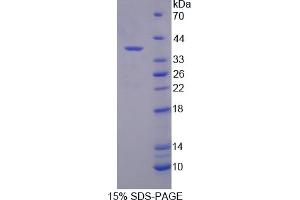 Image no. 1 for Syndecan Binding Protein (Syntenin) 2 (SDCBP2) (AA 1-292) protein (His tag) (ABIN6236961) (SDCBP2 Protein (AA 1-292) (His tag))