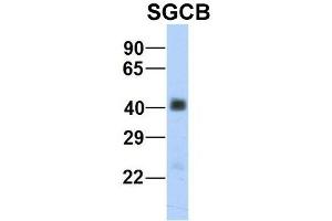 Host:  Rabbit  Target Name:  SGCB  Sample Type:  Human Fetal Heart  Antibody Dilution:  1. (SGCB anticorps  (Middle Region))