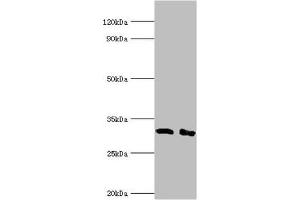Western blot All lanes: Lymphocyte function-associated antigen 3 antibody at 2 μg/mL Lane 1: Hela whole cell lysate Lane 2: Jurkat whole cell lysate Secondary Goat polyclonal to rabbit IgG at 1/10000 dilution Predicted band size: 29, 27, 28 kDa Observed band size: 29 kDa (CD58 anticorps  (AA 40-220))