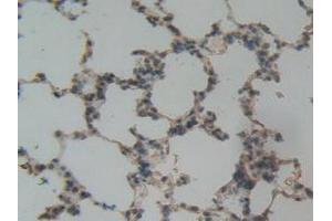 Detection of PAI1 in Rat Lung Tissue using Polyclonal Antibody to Plasminogen Activator Inhibitor 1 (PAI1)