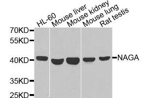 Western blot analysis of extracts of various cells, using NAGA antibody. (NAGA anticorps)