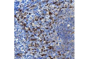 IHC analysis of NOXA2/p67phox/NCF2 using anti-NOXA2/p67phox/NCF2 antibody (ABIN7599462). (NCF2 anticorps  (AA 1-526))