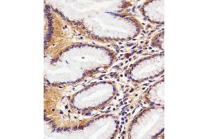 Immunohistochemical analysis of paraffin-embedded H.