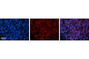 Rabbit Anti-ZFR Antibody     Formalin Fixed Paraffin Embedded Tissue: Human Pineal Tissue  Observed Staining: Cytoplasmic and nuclear in pinelocytes & intersticial cells  Primary Antibody Concentration: 1:100  Other Working Concentrations: 1/600  Secondary Antibody: Donkey anti-Rabbit-Cy3  Secondary Antibody Concentration: 1:200  Magnification: 20X  Exposure Time: 0.
