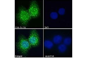 ABIN308459 Immunofluorescence analysis of paraformaldehyde fixed A431 cells, permeabilized with 0. (AUTS2 anticorps  (C-Term))