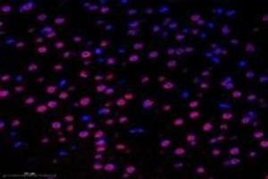 Immunofluorescent analysis of paraformaldehyde-fixed mouse substantia nigra using,SUN2 (ABIN7075502) at dilution of 1: 1000 (SUN2 anticorps)