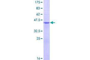 Image no. 1 for COMM Domain Containing 2 (COMMD2) (AA 1-169) protein (GST tag) (ABIN1350013)