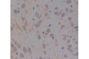 IHC-P analysis of Kidney tissue, with DAB staining. (PTK2B anticorps  (AA 704-941))