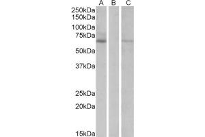 HEK293 lysate (10ug protein in RIPA buffer) over expressing Human MKRN1 with DYKDDDDK tag probed with Makorin Antibody  (1 µg/ml) in Lane A and probed with anti- DYKDDDDK Tag (1/1000) in lane C. (MKRN1 anticorps  (Internal Region))