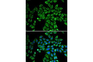 Immunofluorescence analysis of HeLa cells using ANGPT2 antibody. (Angiopoietin 2 anticorps)