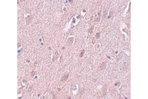 Immunohistochemical staining of human brain tissue with ZC3H12B polyclonal antibody  at 5 ug/mL dilution. (ZC3H12B anticorps  (N-Term))
