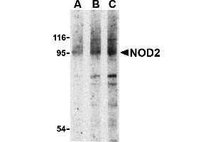 Western Blotting (WB) image for anti-Nucleotide-Binding Oligomerization Domain Containing 2 (NOD2) (N-Term) antibody (ABIN1031482) (NOD2 anticorps  (N-Term))
