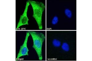 ABIN1590087 Immunofluorescence analysis of paraformaldehyde fixed HeLa cells, permeabilized with 0. (ATF6 anticorps  (AA 437-449))