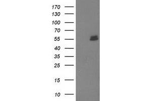 Image no. 1 for anti-U-Box Domain Containing 5 (UBOX5) (AA 1-130), (AA 419-487) antibody (ABIN1490571) (UBOX5 anticorps  (AA 1-130, AA 419-487))