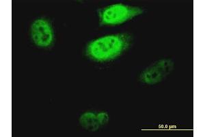 Immunofluorescence of monoclonal antibody to KLF1 on HeLa cell.