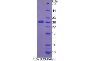 Image no. 1 for Sialidase 1 (Lysosomal Sialidase) (NEU1) (AA 141-286) protein (His tag,SUMO Tag) (ABIN1080361)