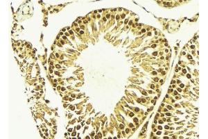 ABIN6269047 at 1/100 staining Mouse testis tissue by IHC-P. (IKBKB anticorps)