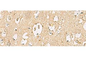 Immunohistochemistry of paraffin-embedded Human brain tissue using LRRC28 Polyclonal Antibody at dilution of 1:60(x200) (LRRC28 anticorps)