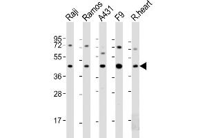All lanes : Anti-MCL1 Antibody (BH3 Domain Specific) at 1:2000 dilution Lane 1: Raji whole cell lysate Lane 2: Ramos whole cell lysate Lane 3: A431 whole cell lysate Lane 4: F9 whole cell lysate Lane 5: A20 whole cell lysate Lysates/proteins at 20 μg per lane. (MCL-1 anticorps  (AA 191-226))