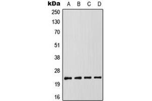 Western blot analysis of RAIDD expression in MCF7 (A), K562 (B), SP2/0 (C), PC12 (D) whole cell lysates. (CRADD anticorps  (Center))