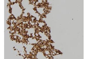 ABIN6275567 at 1/100 staining Mouse lung tissue by IHC-P.