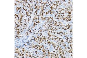 Immunohistochemistry of paraffin-embedded rat ovary using P2RY14 Rabbit pAb (ABIN6131673, ABIN6145126, ABIN6145127 and ABIN6224204) at dilution of 1:200 (40x lens).