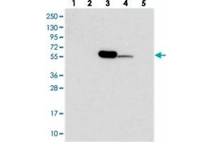 Western blot analysis of Lane 1: RT-4, Lane 2: U-251 MG, Lane 3: Human Plasma, Lane 4: Liver, Lane 5: Tonsil with C11orf80 polyclonal antibody  at 1:250-1:500 dilution. (C11ORF80 anticorps)