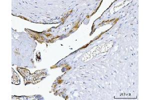 IHC analysis of MIM/MTSS1 using anti-MIM/MTSS1 antibody (ABIN7600276). (MTSS1 anticorps  (AA 17-692))