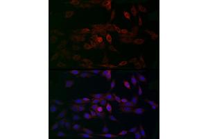 Immunofluorescence analysis of PC-12 cells using MCU Rabbit pAb (ABIN7268549) at dilution of 1:200 (40x lens).