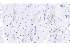 Detection of MYH7 in Human Skeletal muscle Tissue using Monoclonal Antibody to Myosin Heavy Chain 7, Cardiac Muscle, Beta (MYH7)