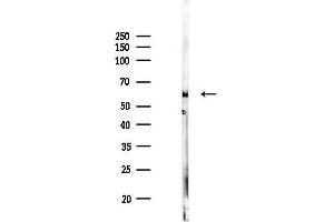 anti-Heparan Sulfate 6-O-Sulfotransferase 2 (HS6ST2) antibody