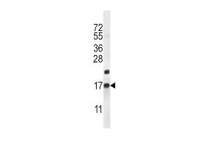 Western blot analysis in mouse heart tissue lysates (35ug/lane). (CARTPT anticorps  (N-Term))