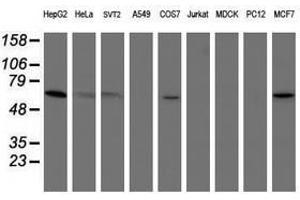 Image no. 5 for anti-Phosphoglucomutase 3 (PGM3) antibody (ABIN1500178) (Phosphoglucomutase 3 anticorps)