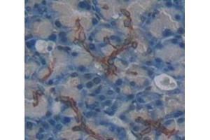 Used in DAB staining on fromalin fixed paraffin- embedded Kidney tissue