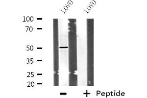 Western blot analysis of extracts from LOVO cells using POLD3 antibody. (POLD3 anticorps  (C-Term))
