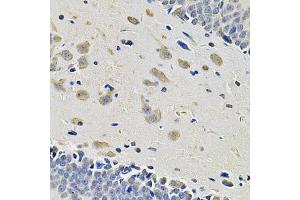 Immunohistochemistry of paraffin-embedded rat brain using ITGA2 Antibody (ABIN5974459) at dilution of 1/100 (40x lens).