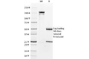 anti-beta-2-Microglobulin (B2M) antibody