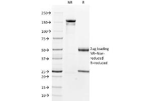 SDS-PAGE Analysis Purified Beta-2-Microglobulin Mouse Monoclonal Antibody (B2M/961). (beta-2 Microglobulin anticorps)