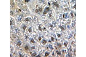 Used in DAB staining on fromalin fixed paraffin-embedded Liver tissue (GATA1 anticorps  (AA 42-292))