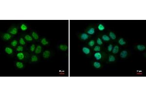 ICC/IF Image MTA1 antibody [C1C3] detects MTA1 protein at nucleus by immunofluorescent analysis. (MTA1 anticorps)