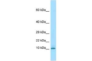 WB Suggested Anti-Krtap3-3 Antibody Titration: 1. (KRTAP3-3 anticorps  (N-Term))