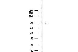 Western blot analysis of lysates from A2780 cells(starvation, 24h treatment), using Phospho-SRF (Ser77) Antibody at 1/1000 dilution.