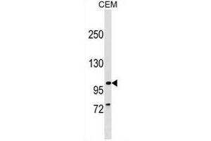 PTHB1 Antibody (C-term) (ABIN1537602 and ABIN2849688) western blot analysis in CEM cell line lysates (35 μg/lane). (BBS9 anticorps  (C-Term))