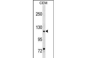 MKL1 Antibody (Center) (ABIN1538460 and ABIN2850260) western blot analysis in CEM cell line lysates (35 μg/lane). (MKL1 anticorps  (AA 497-525))
