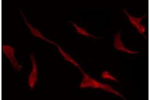 ABIN6275386 staining HuvEc by IF/ICC.