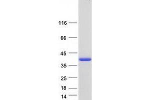 Validation with Western Blot